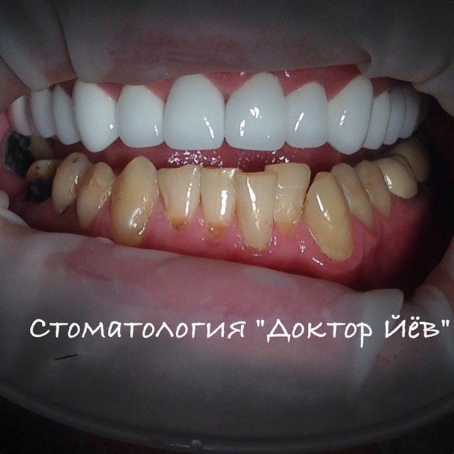 Доктор Йёв