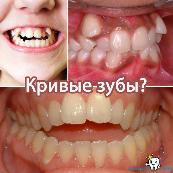 Королевство улыбок
